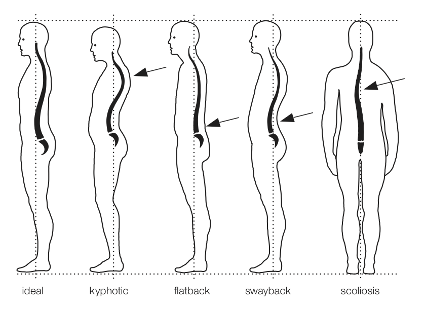 The Five Principles Of Good Posture Explained By Our Ealing Chiropractor -  The Spine and Joint Centre